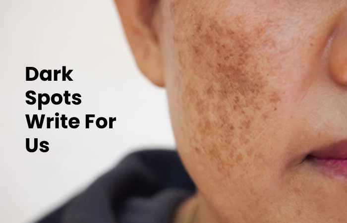 Dark Spots Write For Us
