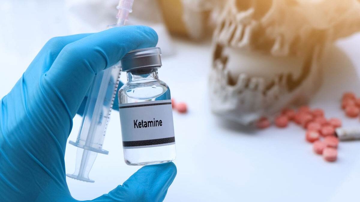 Ketamine Therapy: A Comprehensive Guide to Benefits, Costs